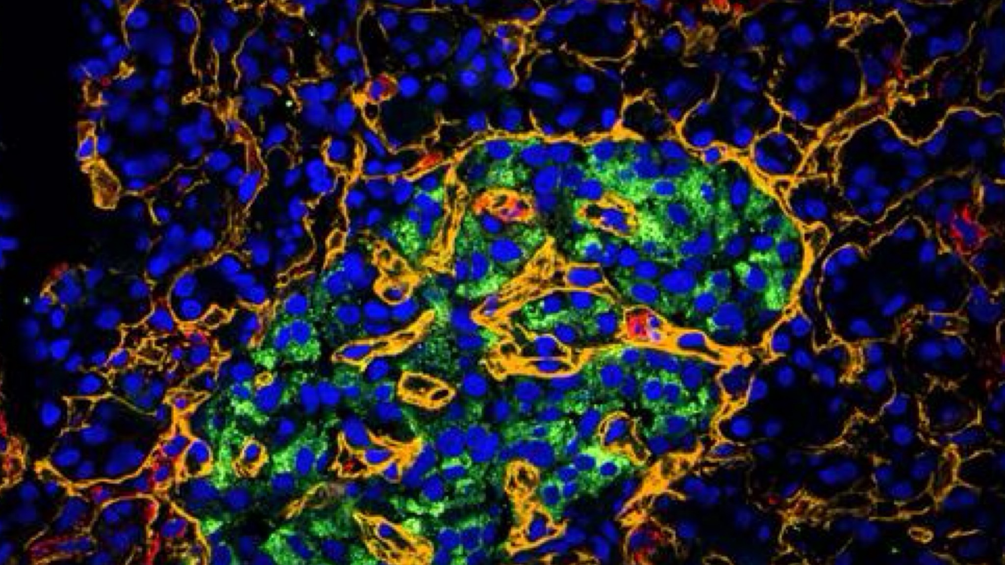 Ciascuna cellula del pancreas svolge un ruolo importante nella regolazione della glicemia. Le cellule che producono insulina (in verde) interagiscono con i vasi sanguigni e le membrane (in giallo) per disperdere l'ormone in tutto il corpo. Gli scienziati di Scripps Research hanno recentemente identificato una nuova cellula, chiamata cellule fibroblastiche associate ai vasi sanguigni (in rosso), che regolano il sistema immunitario e prevengono l'autoimmunità. CREDITO Ricerca Scripps